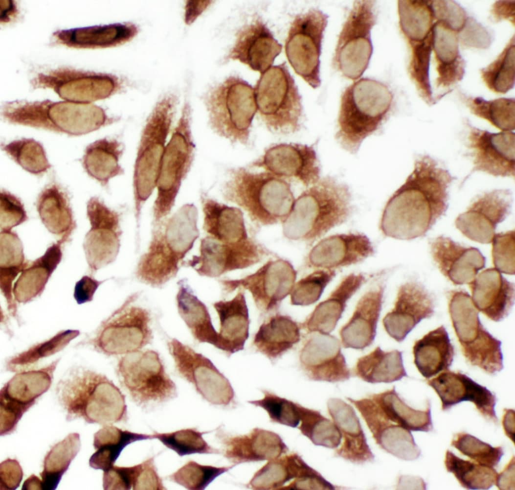 Polyclonal Rabbit anti-Human TRAM1 Antibody (aa314-331, IHC, WB)
