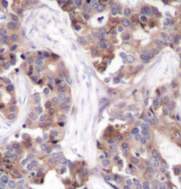 Polyclonal Rabbit anti-Human STMN1 / Stathmin / LAG Antibody (phospho-Ser25, IHC, WB)