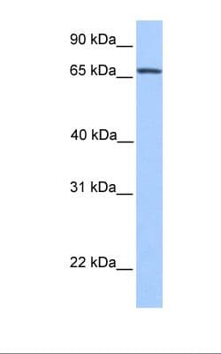 Polyclonal Rabbit anti-Human NR4A2 / NURR1 Antibody (N-Terminus, IHC, WB)