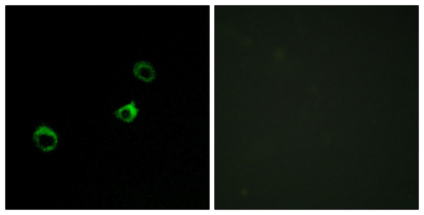 CYB561D1 Antibody