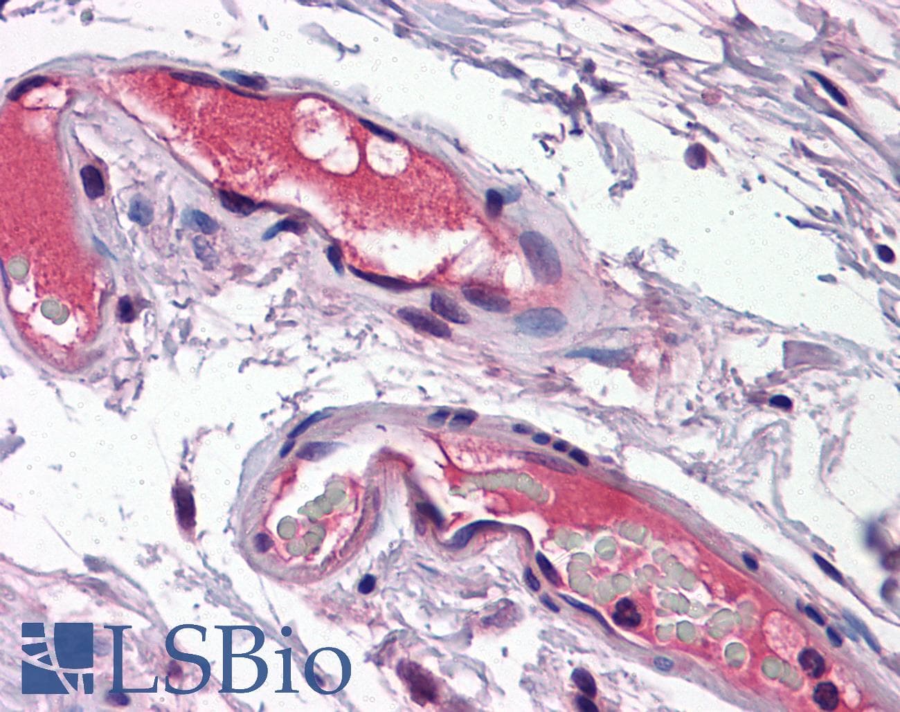 Polyclonal Rabbit anti-Human SPP1 / Osteopontin Antibody (N-Terminus, IHC, WB)