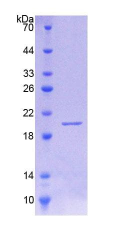 Mouse IL18BP Protein (Recombinant His, N-Terminal)