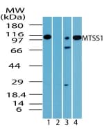 IHC-plus™ MTSS1 / MIM Antibody