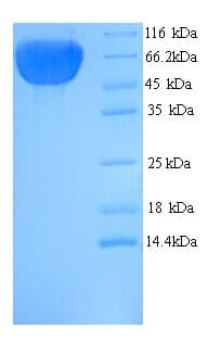 Human KRT77 / Keratin 77 / KRT1B Protein (Recombinant His)