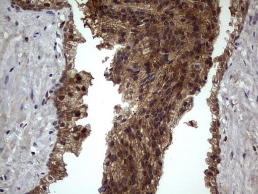 BFSP2 Antibody (aa184-415, clone OTI4E7, Carrier-free)