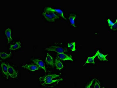 PRKCA / PKC-Alpha Antibody