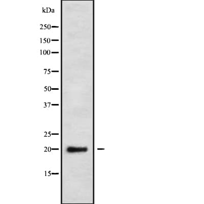 NDUFS4 Antibody