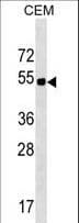 Polyclonal Rabbit anti-Human ELL3 Antibody (aa334-360, WB)