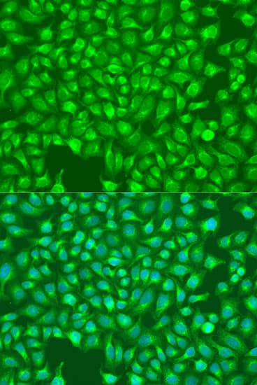 ITPR1 / IP3 Receptor Type 1 Antibody
