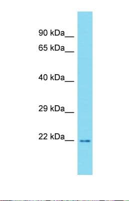 RTKN2 Antibody (C-Terminus)