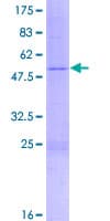 Human RPL10 / Ribosomal Protein L10 (Recombinant GST)