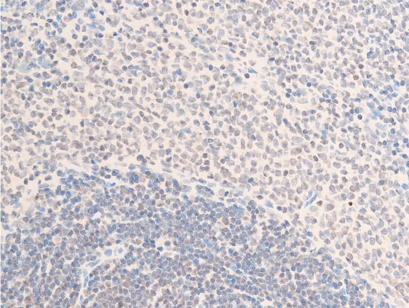 Polyclonal Rabbit anti-Human ERBB2 / HER2 Antibody (phospho-Tyr1112, IHC, IF, WB)