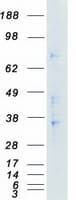 Human NEK6 Protein (Recombinant Myc-DDK (Flag))