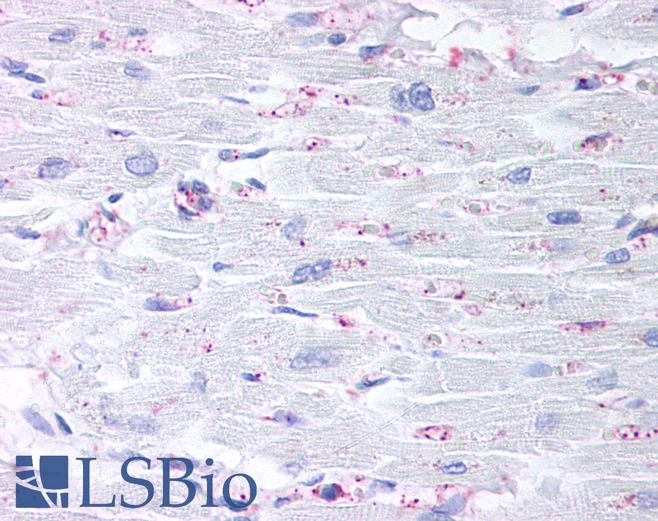 IHC-plus™ Polyclonal Rabbit anti-Human CYSLT2 / CYSLTR2 Antibody (C-Terminus, IHC)