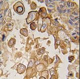 TLR6 Antibody (aa722-753)