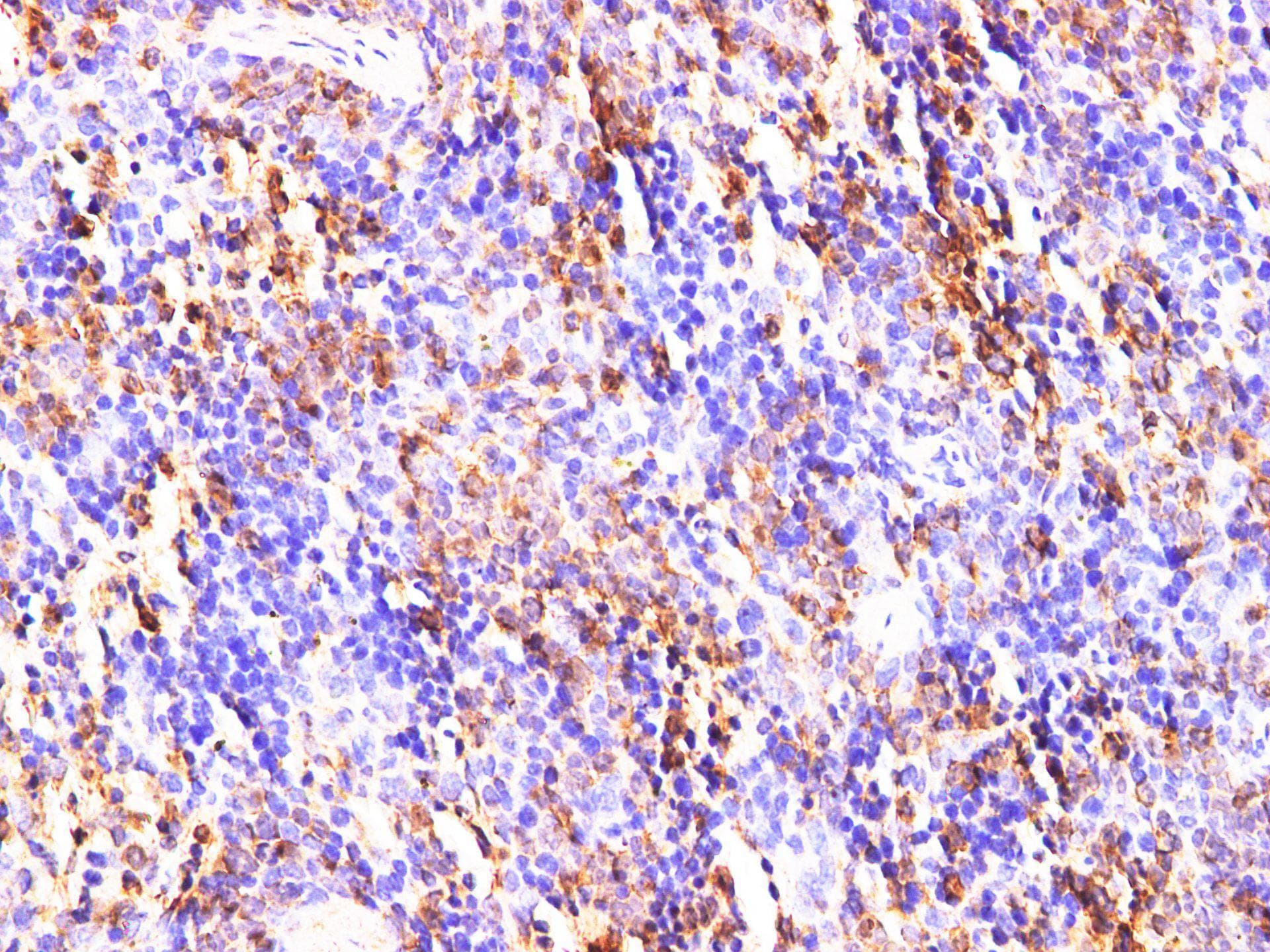 Polyclonal Rabbit anti-Rat S100A9 / MRP14 Antibody (IHC, WB)