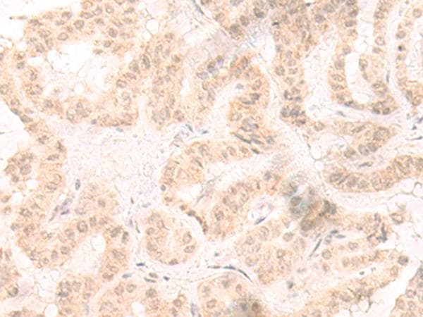 IL-33 Antibody
