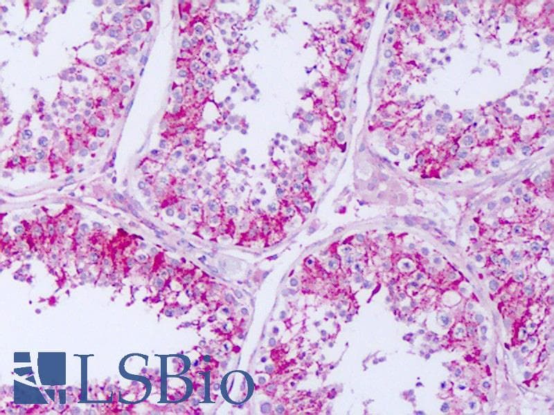RPTN / Repetin Antibody (C-Terminus)
