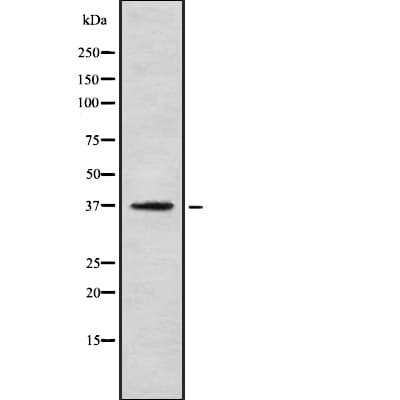 OR5R1 Antibody