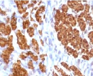 CNN1 / Calponin Antibody (clone CLPN5-1, Ready-to-Use)