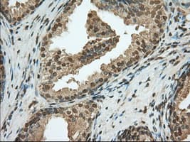 PDE4A / PDE4 Antibody (clone OTI7B11)