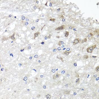 Polyclonal Rabbit anti-Human ETFBKMT Antibody (IHC, WB)