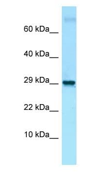 Polyclonal Rabbit anti-Mouse LMO2 Antibody (aa131-180, WB)