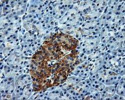 ATP5B / ATP Synthase Beta Antibody (clone OTI1F7, Carrier-free)