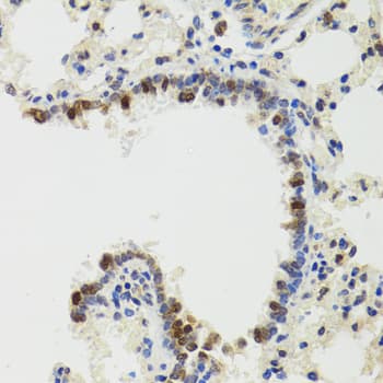 IKBKG / NEMO / IKK Gamma Antibody