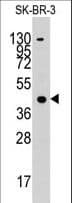 IHC-plus™ ACAT1 Antibody (aa296-329)