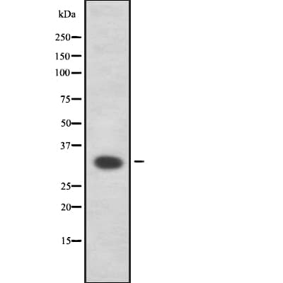 HSD17B11 Antibody