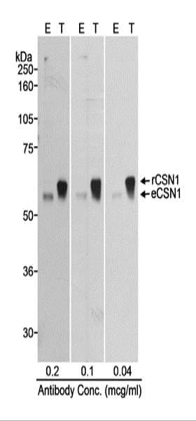 GPS1 / CSN1 Antibody (aa400-C-term)
