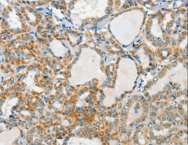 Polyclonal Rabbit anti-Human AANAT Antibody (IHC)