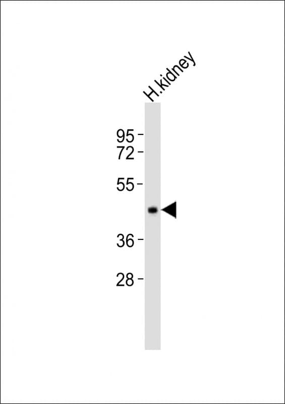 INPP5A Antibody (aa306-340)