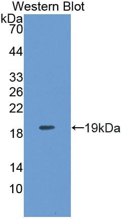 INPP4A Antibody (aa1-137, FITC)