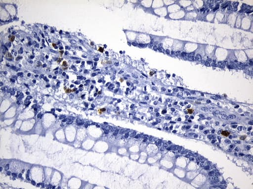 TS / Thymidylate Synthase Antibody (clone UMAB227)