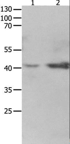 LRPAP1 Antibody