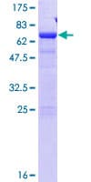 Human SDCCAG8 Protein (Recombinant GST)