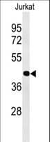 Polyclonal Rabbit anti-Human ATF1 Antibody (aa193-219, WB)