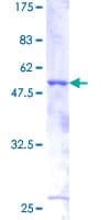 Human BTC / Betacellulin Protein (Recombinant GST)