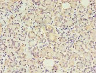 GIT2 Antibody
