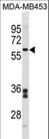 Polyclonal Rabbit anti-Human FMO5 Antibody (aa474-502, WB)