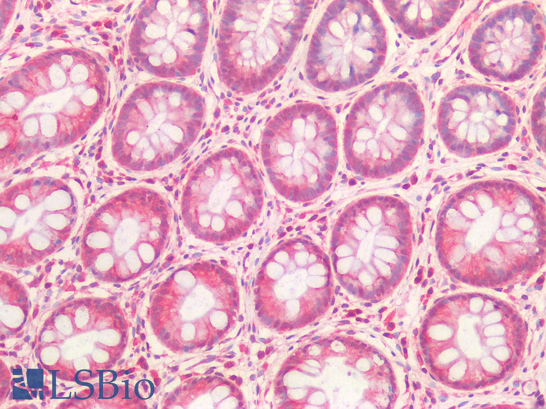 IHC-plus™ Polyclonal Rabbit anti-Human HGF / Hepatocyte Growth Factor Antibody (IHC)