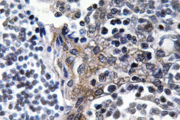 VASP Antibody (phospho-Ser157)