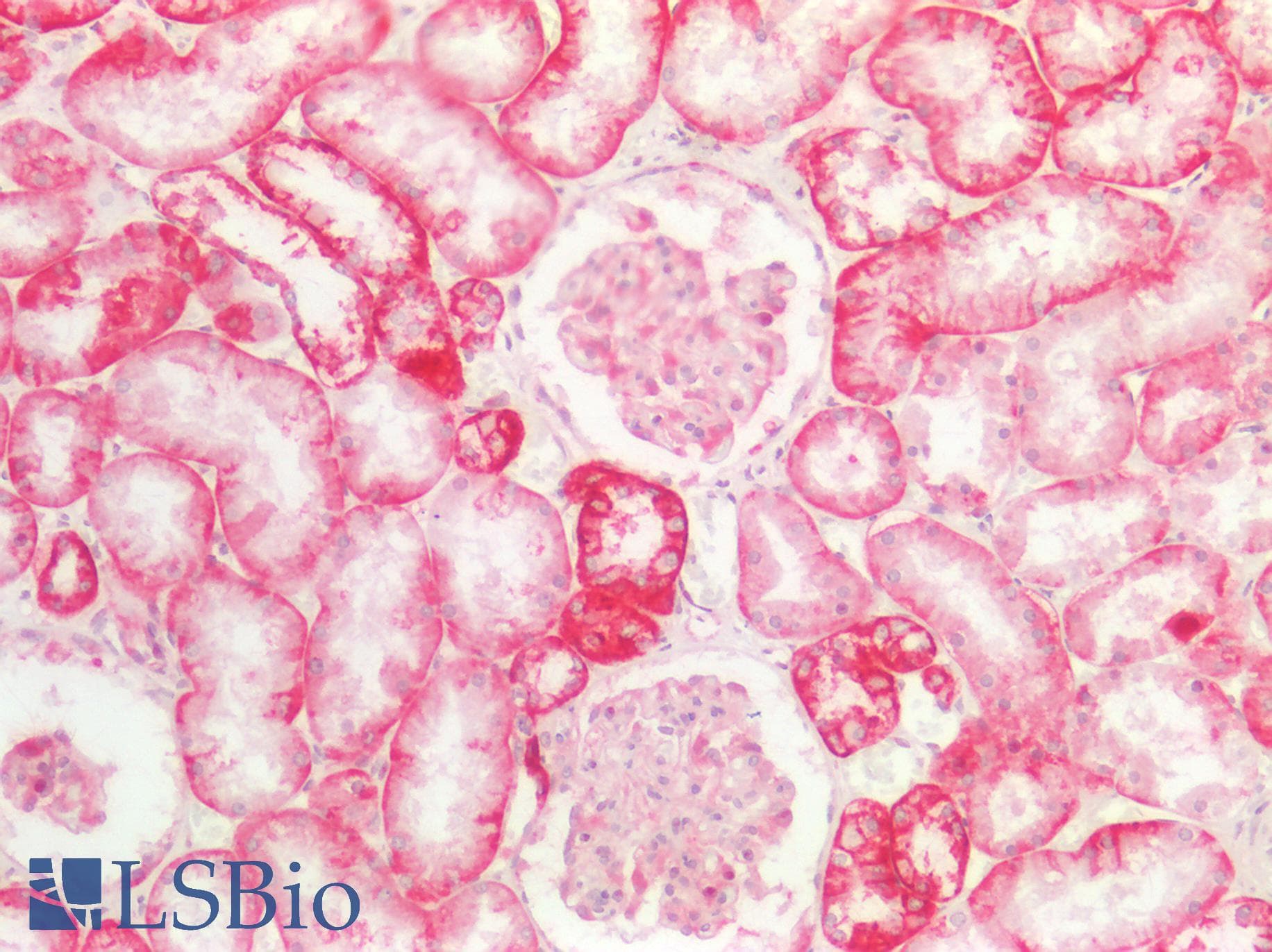 PathPlus™ NDRG1 Antibody