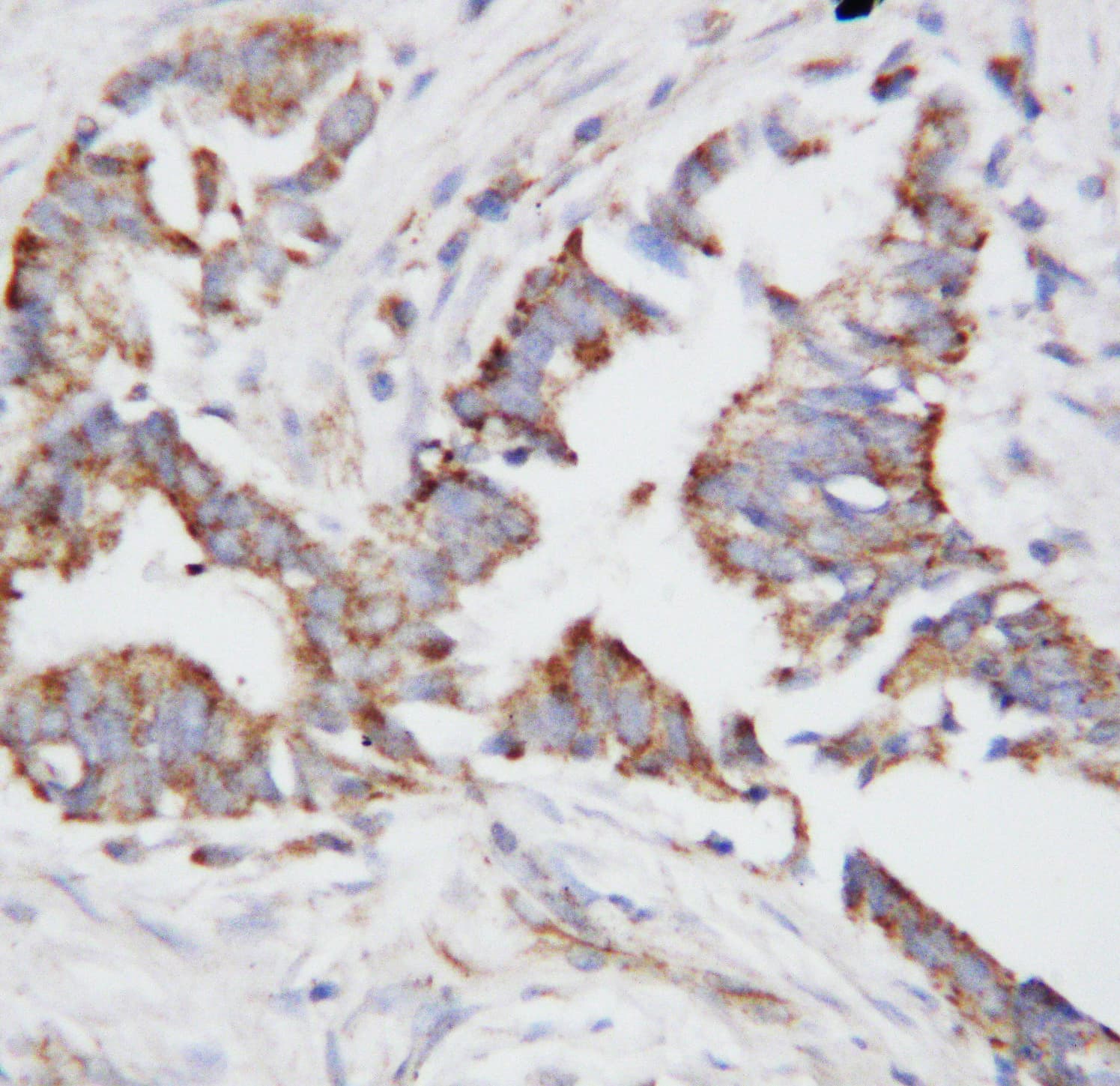 SPP1 / Osteopontin Antibody (aa28-47)