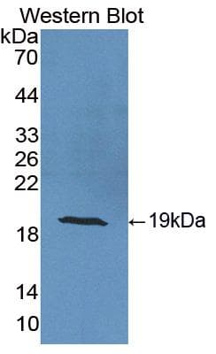 CRABP2 Antibody (aa1-138, PE)