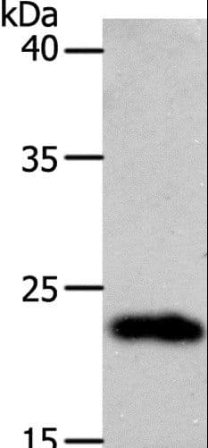 SOCS1 Antibody