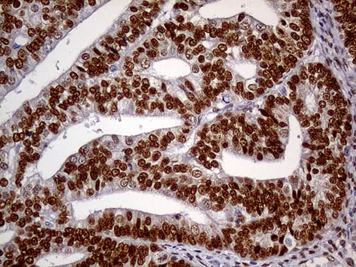 Monoclonal Mouse anti-Human MEIS1 Antibody (clone OTI2A3, Carrier-free, aa176-390, IHC, WB)