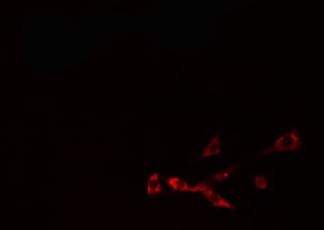 Polyclonal Rabbit anti-Human NBL1 / DAN Antibody (IHC, IF, WB)
